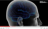 View neurofeedback video